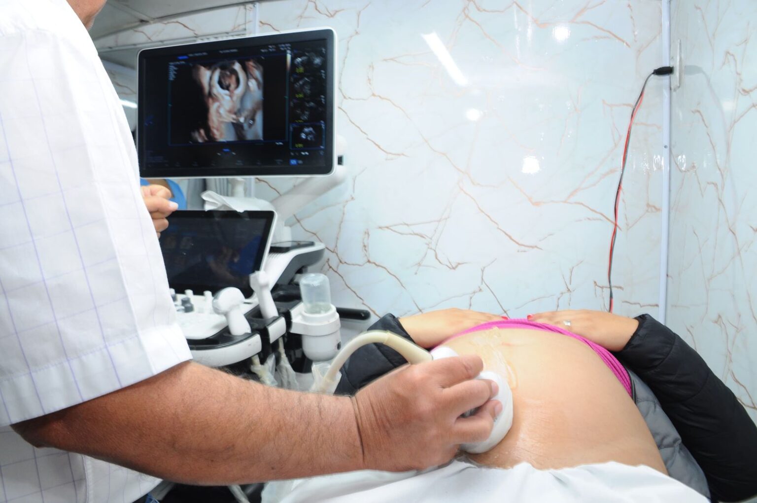 Aparecida de Goiânia: Mutirão de exames amplia acesso à saúde nesta sexta-feira (19/6)
