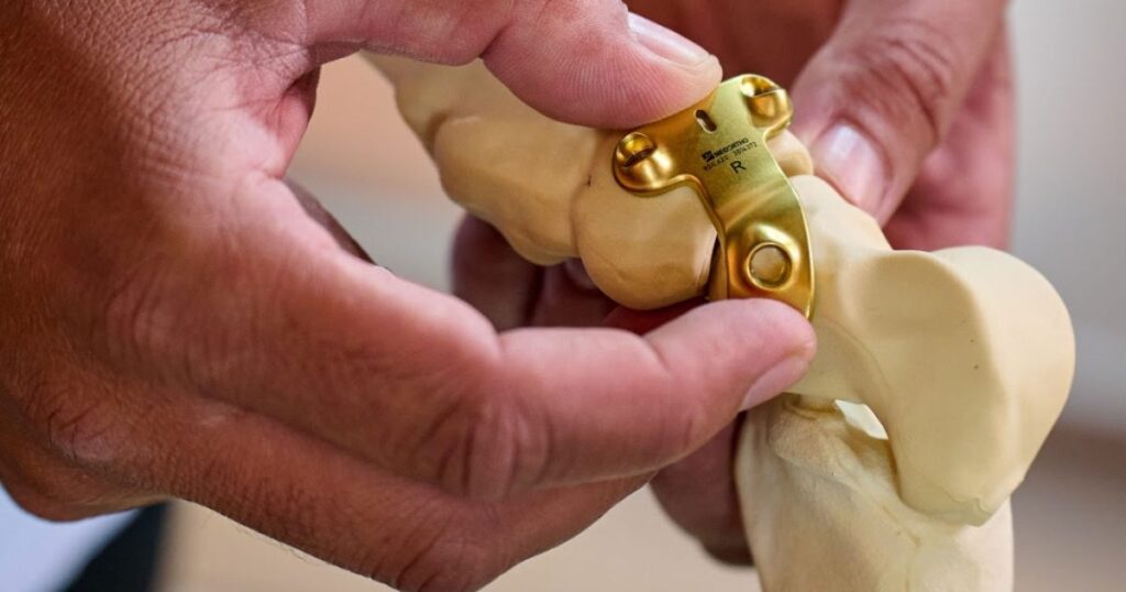Saúde dos pés: como cuidar para prevenir lesões e traumas